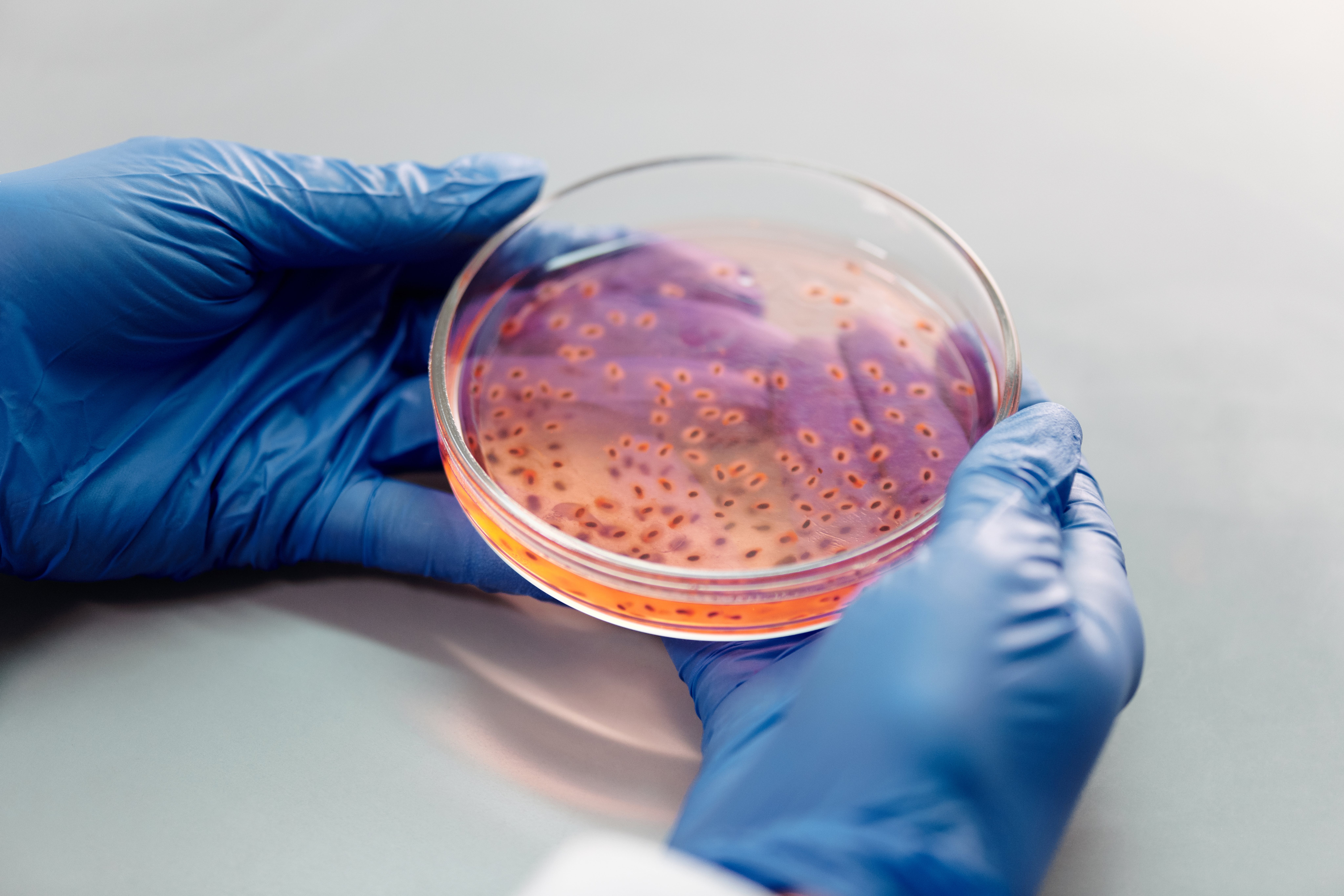 How to Excel in Your Microbiology Final Exam: A Comprehensive Guide